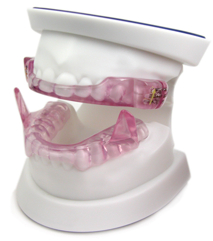 睡眠時無呼吸症候群 - こうざい歯科クリニック(三島市・駿東郡清水町)